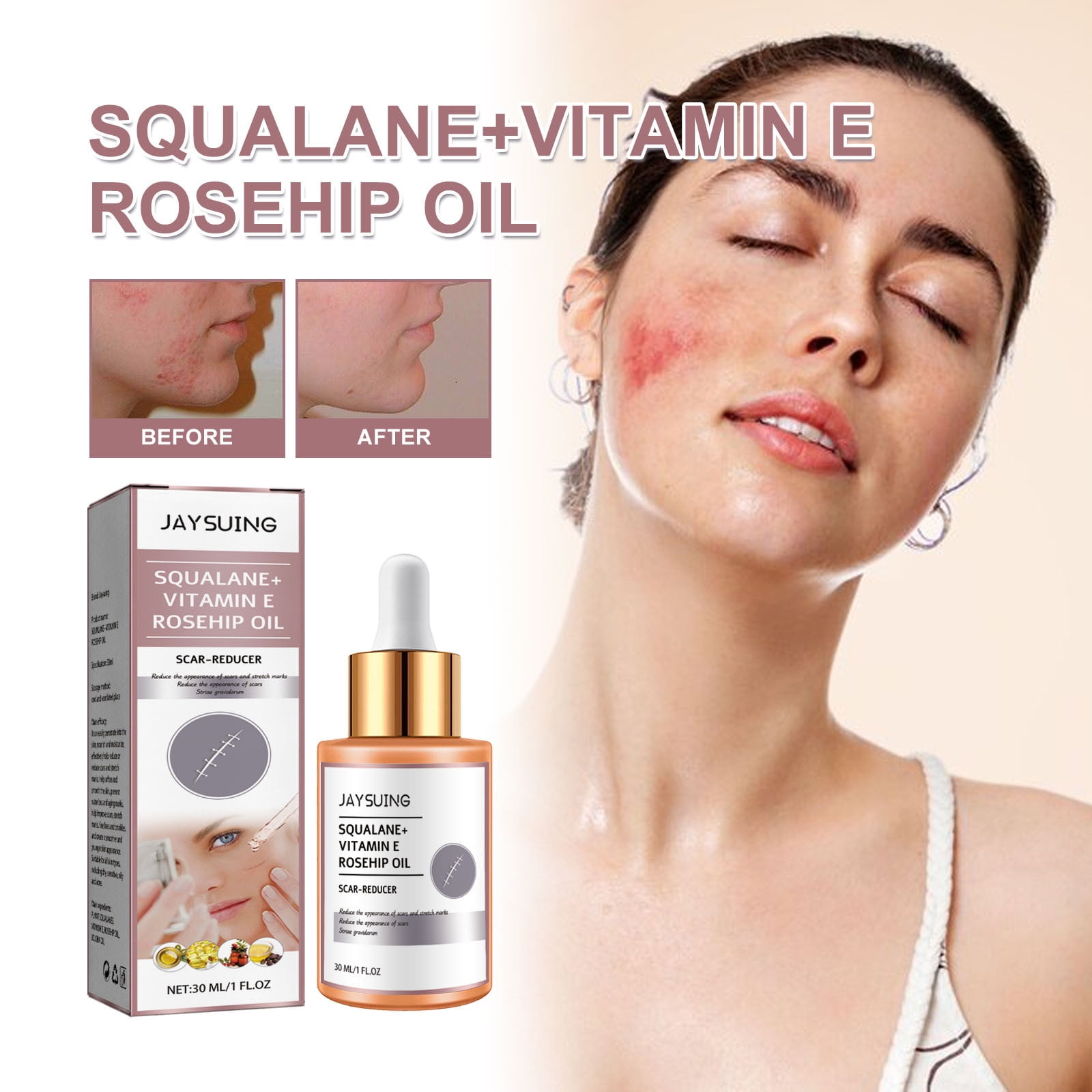 ScarReducer Squalane + E Rosehip Oil Moisturizer for Face Hydrate