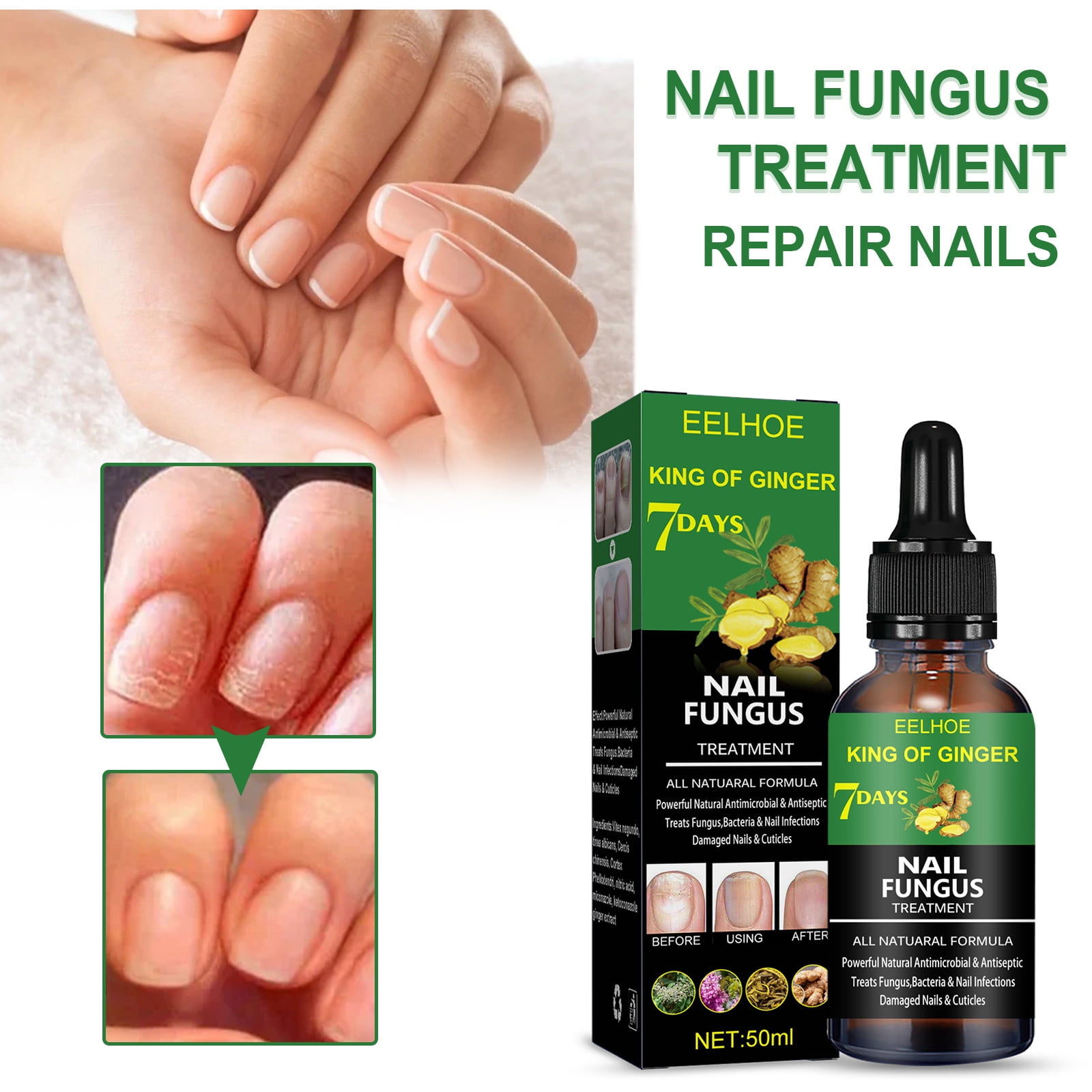 Types & Stages of Toenail Fungus | Premier Podiatry