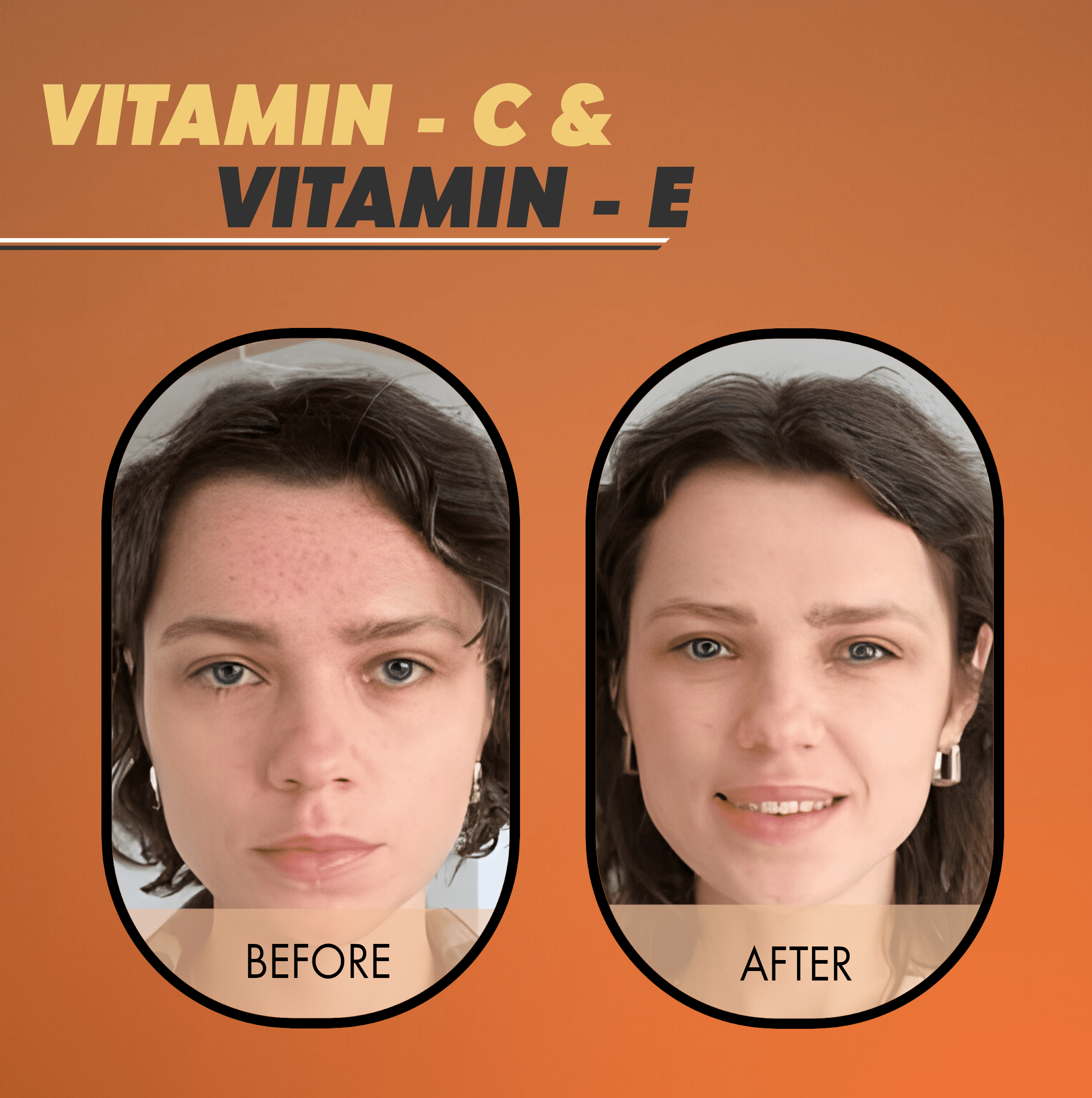Premium 5% Vitamin C Serum For Face with Hyaluronic Acid, Retinol & Amino Acids - Boost Skin Collagen,Hydrate & Plump Skin, Anti Aging & Wrinkle Facial Serum 30ml