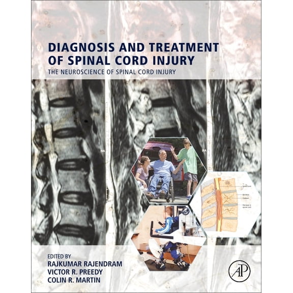 Diagnosis and Treatment of Spinal Cord Injury, (Hardcover)