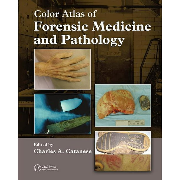 Color Atlas of Forensic Medicine and Pathology (Paperback) Walmart
