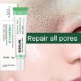 thumbnail image 3 of Crema retráctil de poros con ácido salicílico, eliminación rápida de poros grandes, eliminación de puntos negros, estiramiento de la cara, piel suave, producto coreano para el cuidado, 3 of 5