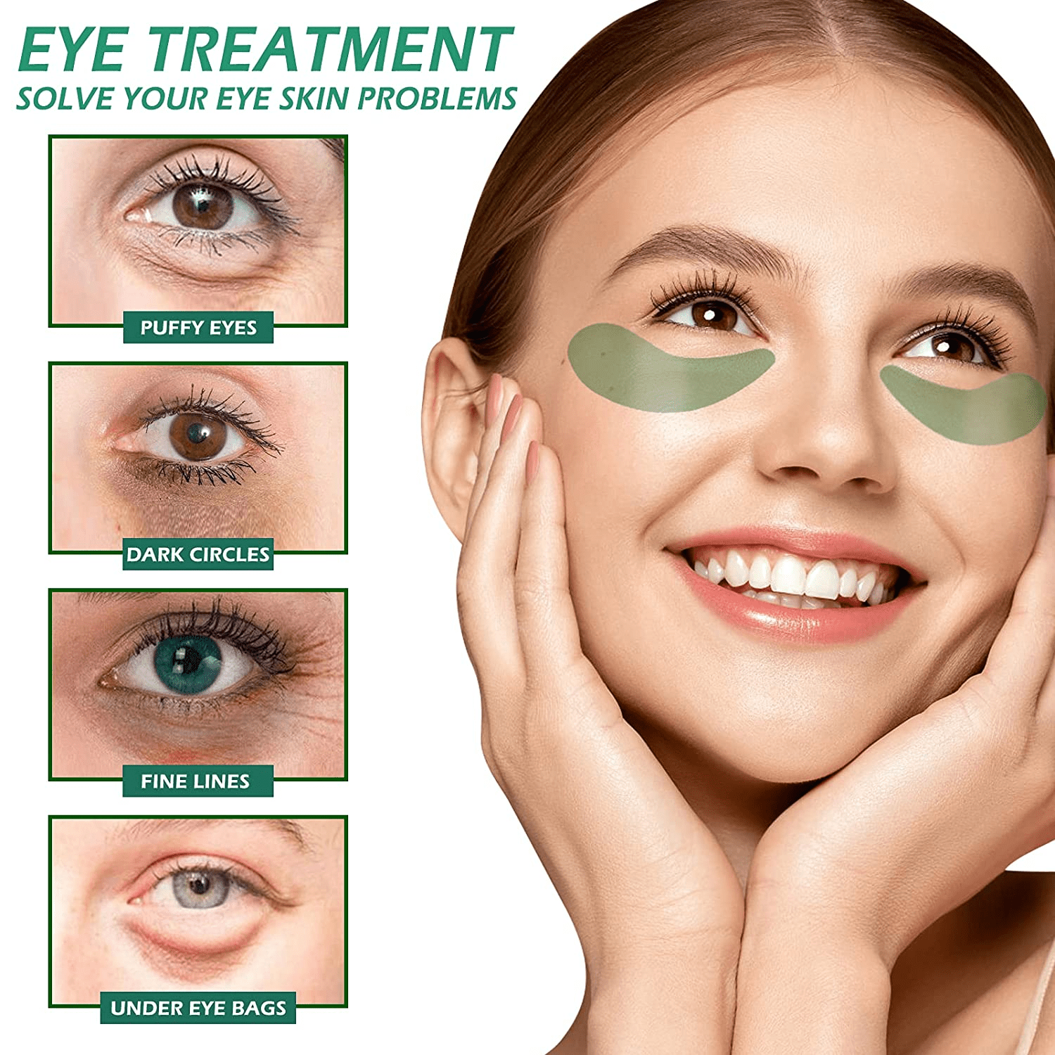 Under eye bags causes home remedies cosmetic treatments and other  alternatives