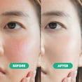 thumbnail image 2 of SoloVegan 0.5% LHA Soothing Serum + Moisturizer, 2 of 7
