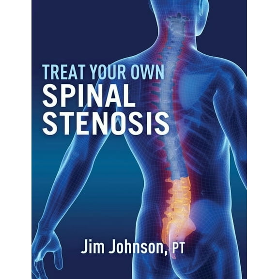 Treat Your Own Spinal Stenosis, (Paperback)