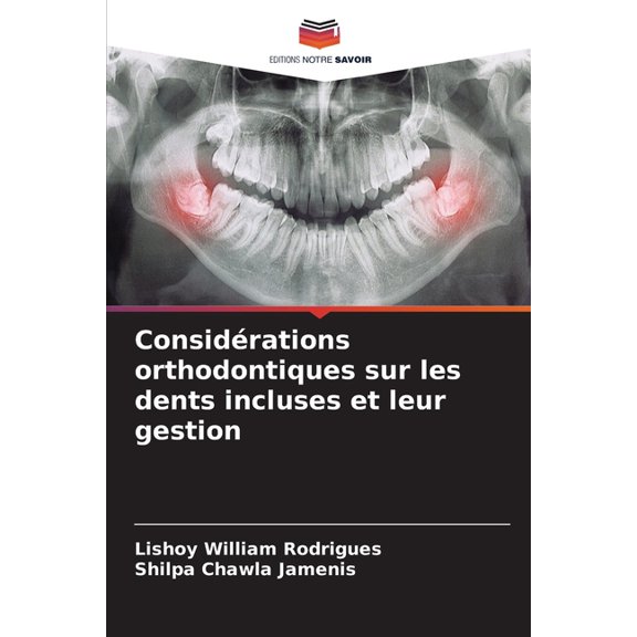 ConsidÃ©rations orthodontiques sur les dents incluses et leur gestion, (Paperback)