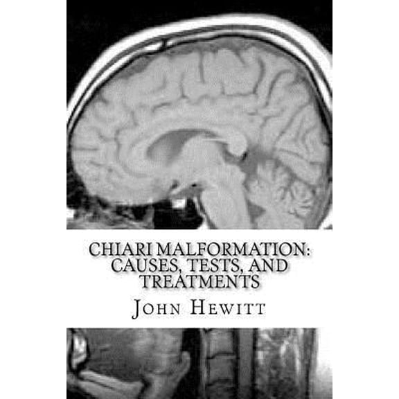 Pre-Owned Chiari Malformation: Causes, Tests, and Treatments