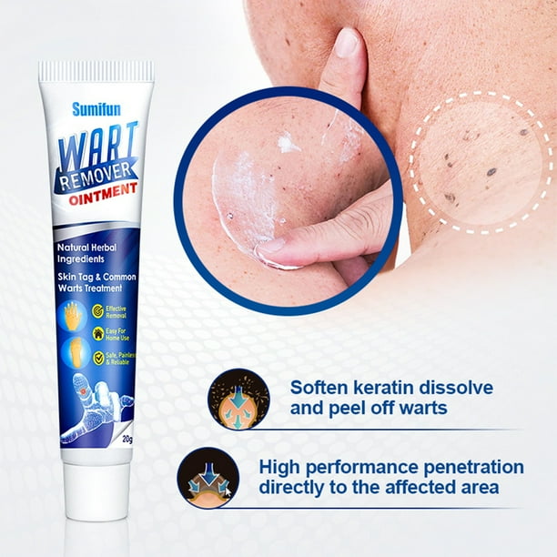 Crema Removedora De Verrugas Tmvgtek Cuidado Belleza | Bodega Aurrera en  línea