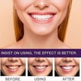 thumbnail image 5 of 1/2/3x 7-Pro Intensive Toothpaste,Upgrade Natural Whitening Mint for Deep Stain Remover, 5 of 5
