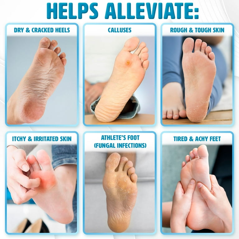 NGU Next Gen U Foot Cream, Antifungal Mint Foot Lotion,