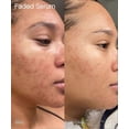 thumbnail image 4 of Brighten Face Serum, Smooth Face Nourishment Improve Skin Regeneration Fade Fines Line Anti-Anging Repair Face Serum, 4 of 5