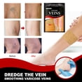 thumbnail image 2 of Parches para venas varicosas, alivio de araña en las piernas, promueve el metabolismo, yeso para flebiti Tmvgtek 12 uds Cuidado Belleza, 2 of 6