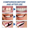 thumbnail image 3 of Resin Tooth Repair Glue Shapeable Teeth Gaps Filling Solid Temporary Teeth Repair Falseteeth Glue Safety 1/2/3pcs, 3 of 5