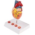 thumbnail image 1 of 1: 1 Modelo Estrutura de Sistema Corazones Patológico Trombo de 4 Juguete Educativo Escolar Sunnimix Estatua del corazón humano, 1 of 8