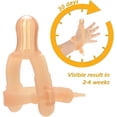 thumbnail image 2 of Kids Thumb Sucking Stop - Infants 0-3 Years - Silicone Sucking Adjustable Thumb Guard, 2 of 5