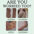 thumbnail image 5 of Oil Foot Cream With Vitamin E Aloe Peppermint Nourishing Hydrating For Dry Feet Care Application 55g, 5 of 8