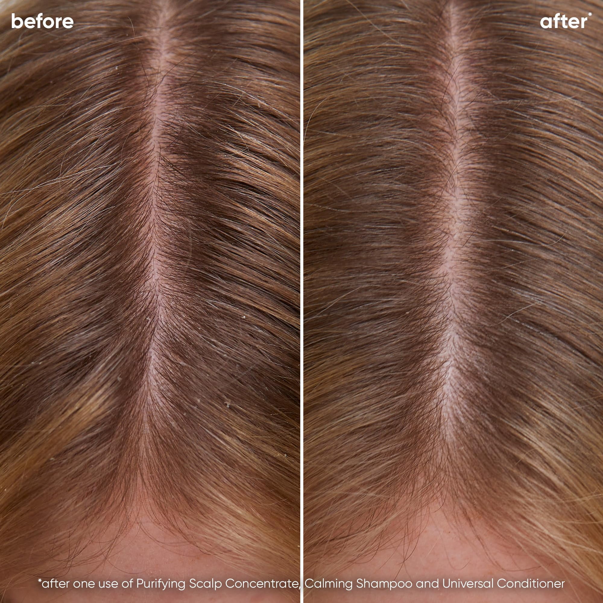 Biolage Scalp Sync Calming Shampoo | Calms & Hydrates Dry or Irritated Scalp | Paraben & Silicone Free | For Sensitivity Control | Vegan & Cruelty Free | Salon Shampoo C31