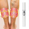 thumbnail image 3 of White(A)$Blue Light Therapy Varicose Vein Pen, 3 of 4