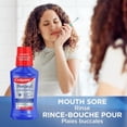 thumbnail image 2 of Colgate Rinçage pour Plaies Buccales au Peroxy Menthe, 2 of 5