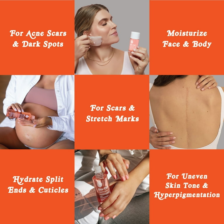 Best oil 2024 for acne scars