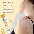 thumbnail image 4 of Vitiligo Bee-Venom Treatment Cream for Skin Pigmentation, Psoriasis Relief, Reduces White Spots, Portable Anti-itch Ointment for All Skin Types, 4 of 5