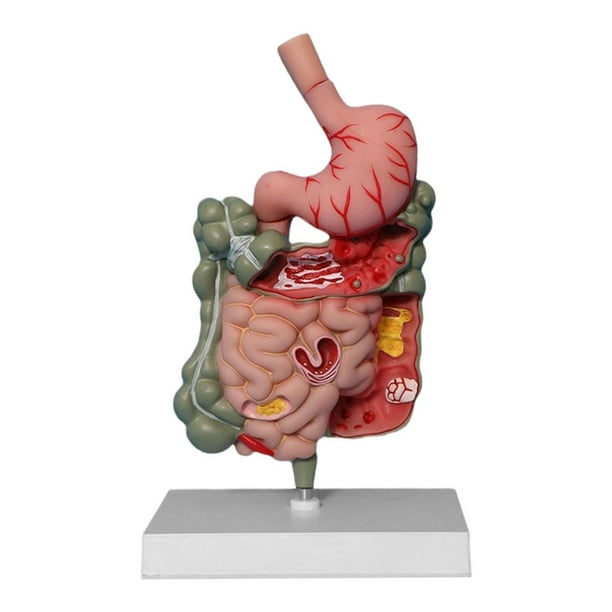 digestivo humano Modelo de intestino grande CECUM Modelo de PVC Modelo de enseñanza Sturdy Scientific Medical para aula de exhibición