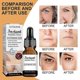 thumbnail image 2 of Jaysuing Face Serum Wrinkles Remover Anti-aging Fade Fine Lines Serum Whiten -8388399996923, 2 of 5