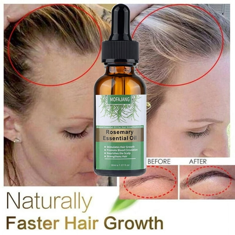 100% Pure Rosemary Oil Fast For Hair Growth Essential Oil Anti Hair Loss  Serum