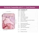 thumbnail image 2 of Funda para tablet Dadanism para iPad 11.ª generación, iPad 10.9, 2 of 7