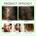 thumbnail image 4 of Rosemary thickening shampoo, plant-based oil control, fluffy, long-lasting, refreshing, not flat, repair frizzy hair, plump and strong, suitable for both men and women, 4 of 11