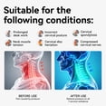 thumbnail image 4 of Owlprince Neck Brace for Pain Relief & Neck Support, Cervical Spine Alignment Neck Collar, Tech Neck, Hump, Forward Head Posture Corrector, Gray, L, 4 of 10