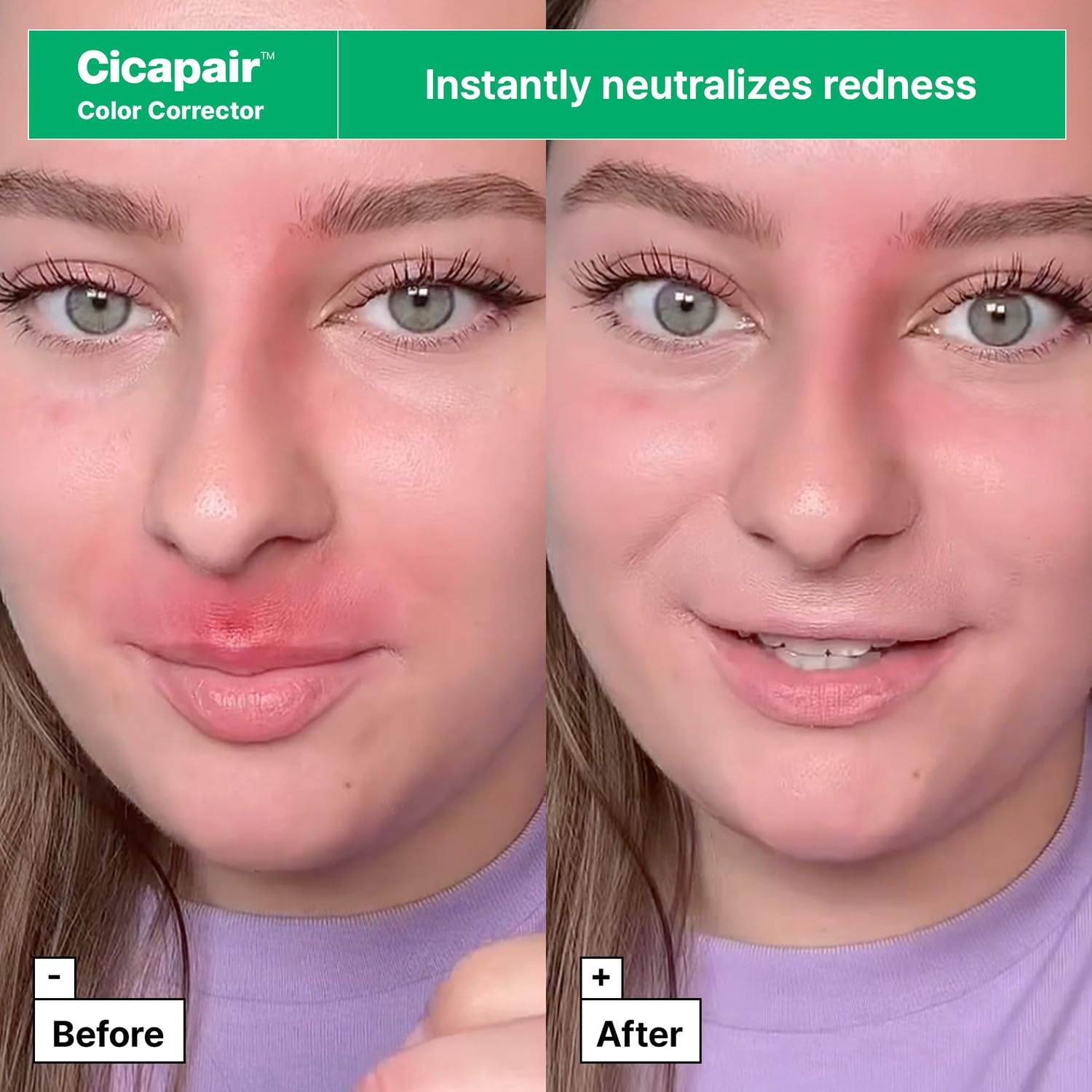 Dr.Jart+ Cicapair Redness Rescue Travel Size Value Kit, Suitable for Sensitive Skin | Korean Skin Care, 1 Count