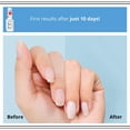 thumbnail image 5 of Eveline Cosmetics Total Action 8 in 1 Intensive Nail Conditioner, 0.4 fl oz, 5 of 8