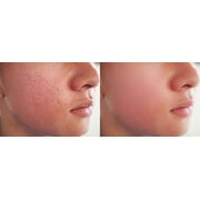 Extra Care Lotion No2 Pore Tightening Sebum Regulating Action - Oily Skin
