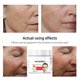 thumbnail image 2 of Suero antienvejecimiento antiarrugas altamente eficaz para eliminar las arrugas faciales, Reduce las líneas finas, apretar la piel, cuidado de la piel Facial, 2 of 5