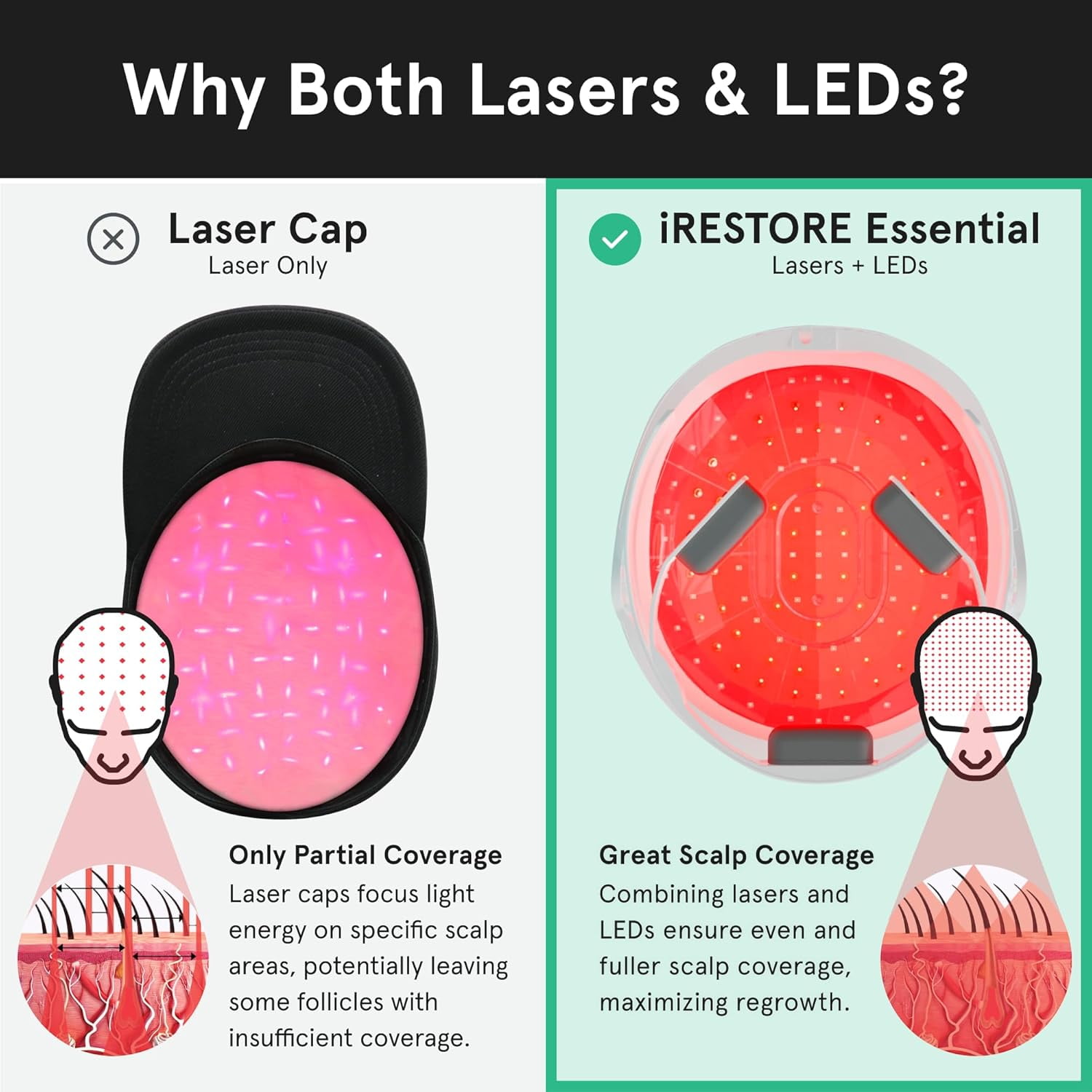 iRestore Laser Hair Growth System FDA Cleared Hair Loss Treatment for Men and Women