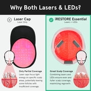 iRestore Laser Hair Growth System FDA Cleared Hair Loss Treatment for Men and Women