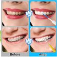 thumbnail image 4 of ACDANC 255 Pieces Braces Flossers for Braces,Interdental Brush Soft Dental Floss Picks Braces Cleaning Kit Toothpick Dental Brush Braces Teeth Flossers Brushes for Tooth Cleaner(Multiple Sizes), 4 of 9