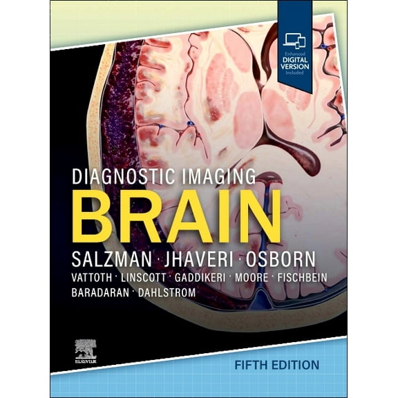 Diagnostic Imaging Diagnostic Imaging: Brain, (Hardcover)