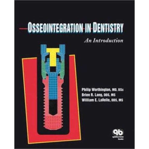 Pre-Owned Osseointegration in Dentistry: An Introduction (Paperback) 0867152818 9780867152814