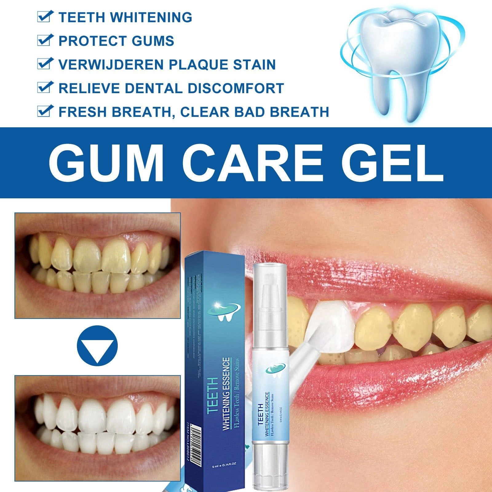 Plaque for Brushing Teeth Travel Plaque Remover at Home Plaque Removal Wf010 M Teeth X5 Toothbrush Teeth ning Accelerator Light Oral Pick for Teeth Braces Picks for Teeth Stone Remover Cavity