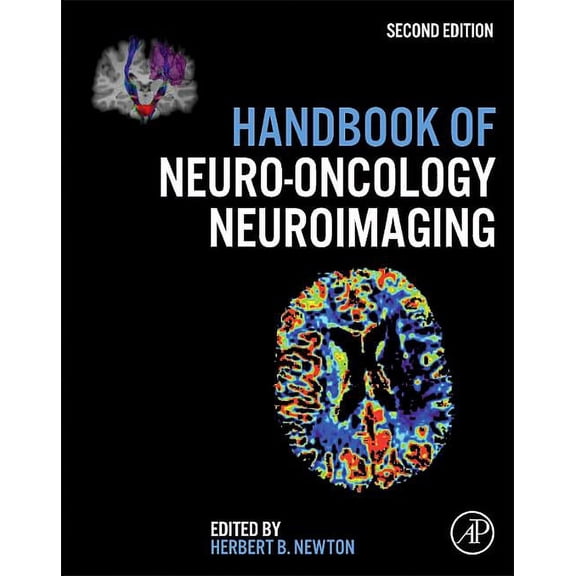 Handbook of Neuro-Oncology Neuroimaging, (Hardcover)