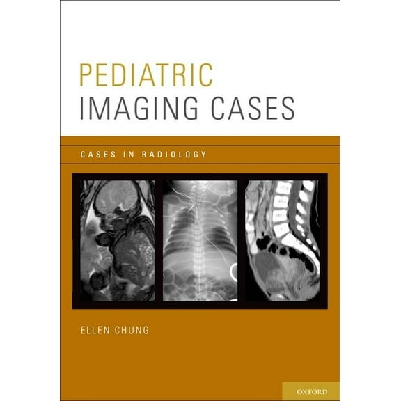 Cases in Radiology Pediatric Imaging Cases, (Paperback)