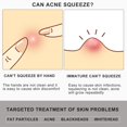 thumbnail image 5 of Gel para trenzado de sujeción fuerte de 8,8 onzas para trenzas trenzadas, controla el encrespamiento, alto brillo, sin escamas, fácil control de bordes, 5 of 5