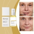 thumbnail image 4 of Suero hialurónico 50 ml Hidratación y retención Relleno y suaviza el envejecimiento Apto para todo tipo de rostro Suero facial, 4 of 5