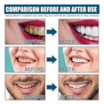 thumbnail image 5 of Jaysuing mouthwash removes tooth stains, removes odor and bad breath, freshens the mouth and maintains oral health. | |, 5 of 5