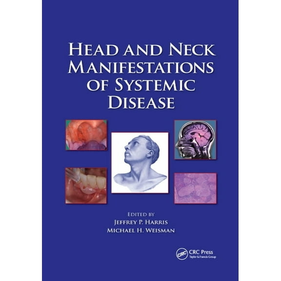 Head and Neck Manifestations of Systemic Disease, (Paperback)