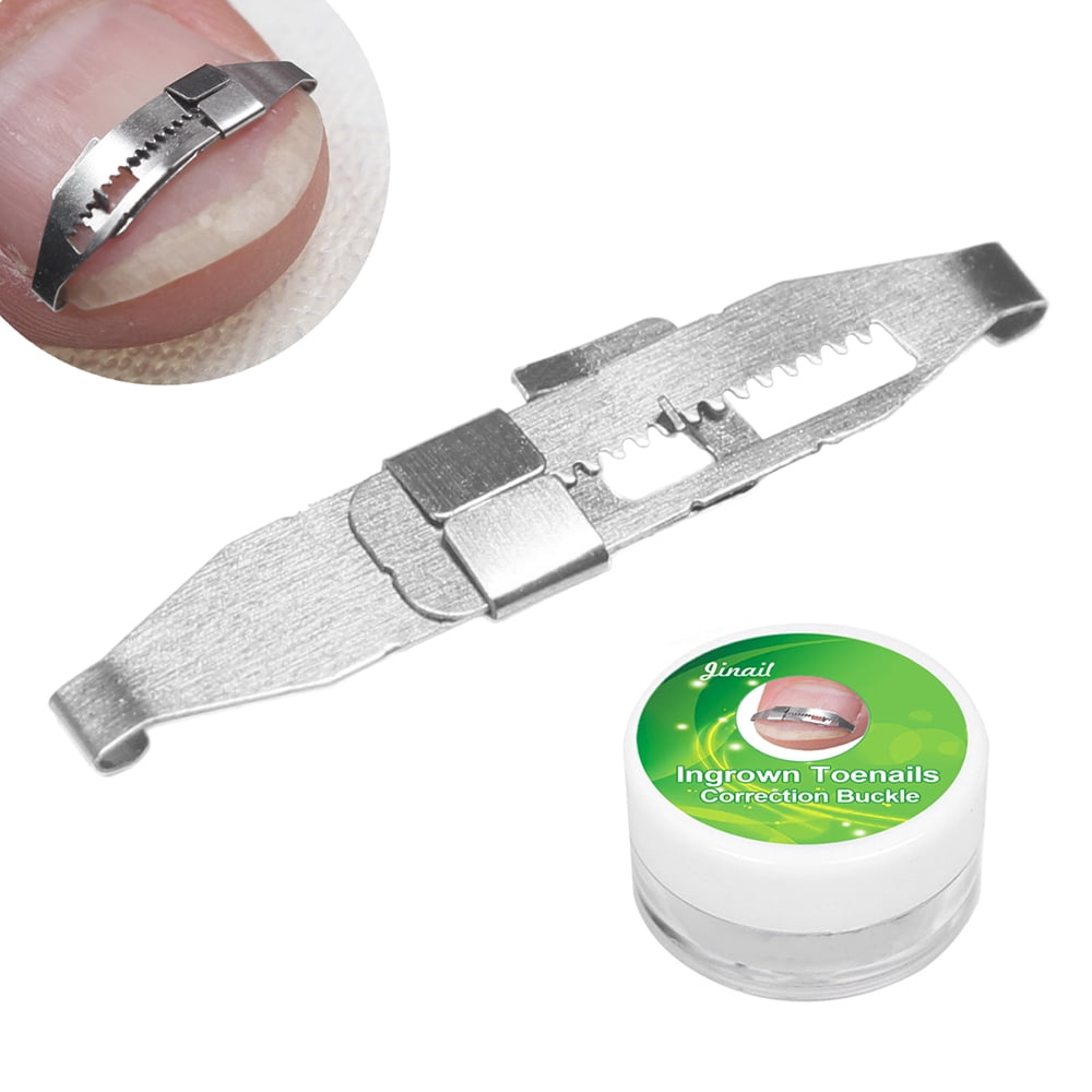 Ingrown Toenail Corrector Toenail Correction Tool Foot Nail Care Tool