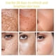 thumbnail image 2 of Suero abrillantador para la cara, producto coreano, eliminador de manchas oscuras, pecas, aclara la marca del acné, blanqueamiento, mejora la luminosidad, hidrata la piel, 2 of 5
