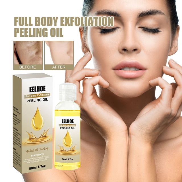 Hot6sl Ofertas de La Semana Aceite Exfoliante Amarillo En Máxima Potencia para Los Nudillos, Blanqueador de Piel Muerta, Aceite Exfoliante para Manchas Oscuras, 100 Ml
